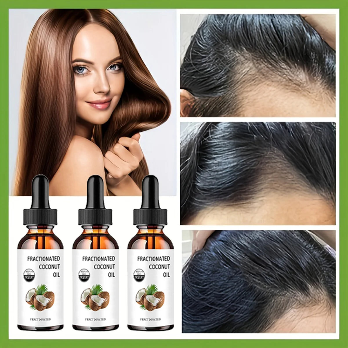 TRSTAY Pure Fractionated Coconut Oil – Anti-Aging Face & Body