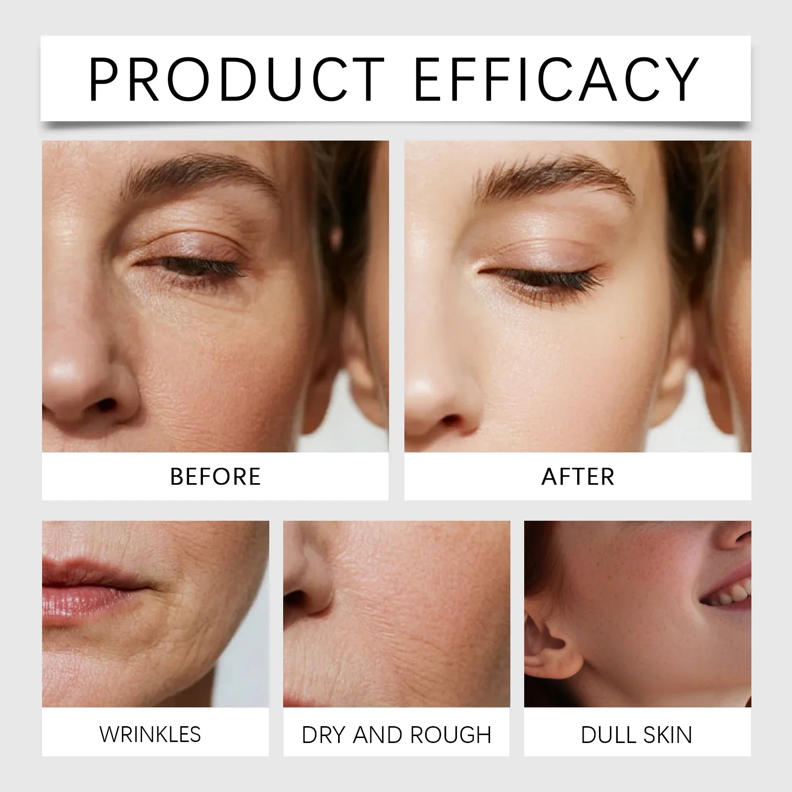 Oligopeptide Microneedle Face Serum – Hyaluronic Acid Essence