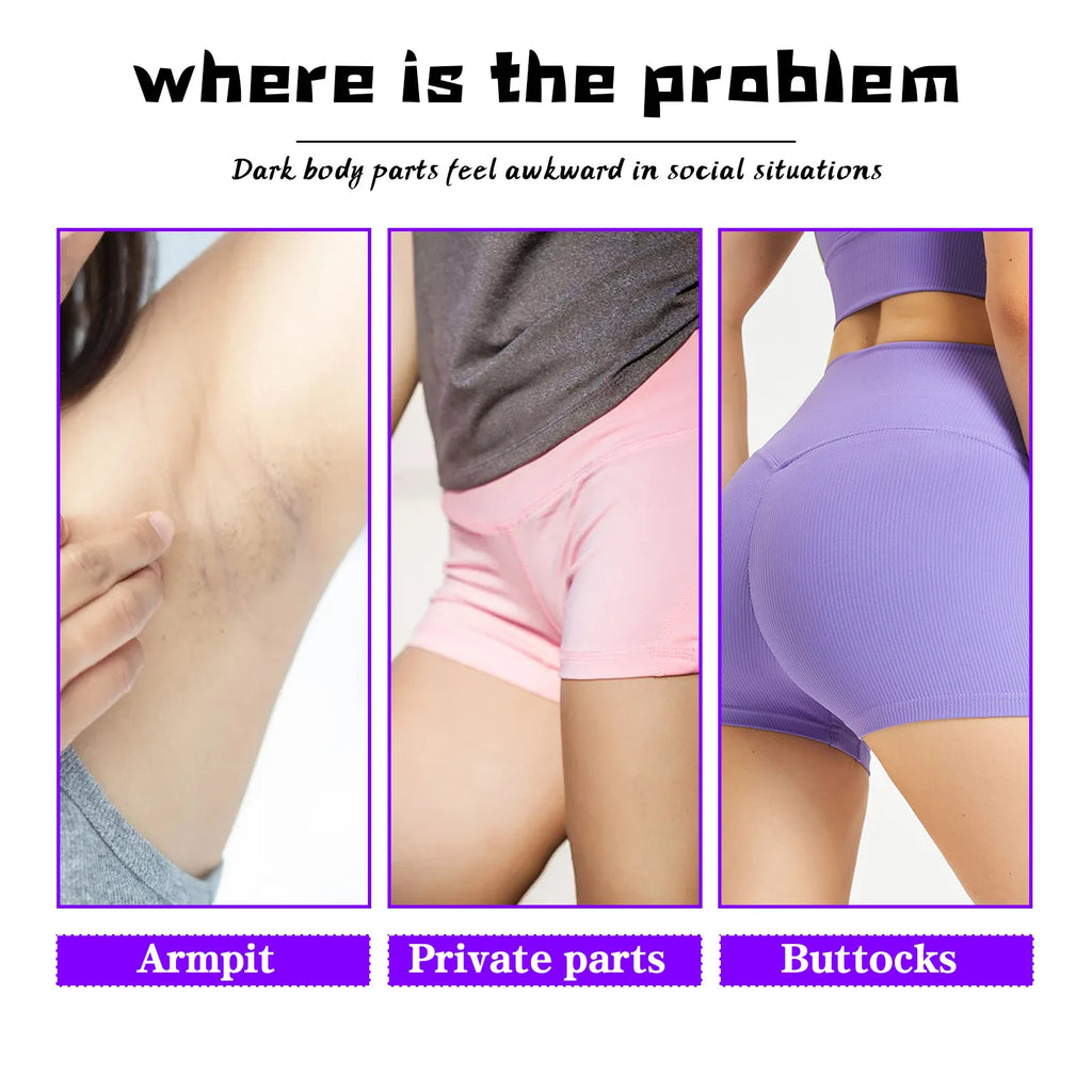Private Parts Whitening Cream Inner Thigh Darkness Removal Whiten Butt Elbow Dark Spot Melanin Removal Body Snow Bleach Cream Oasis Select