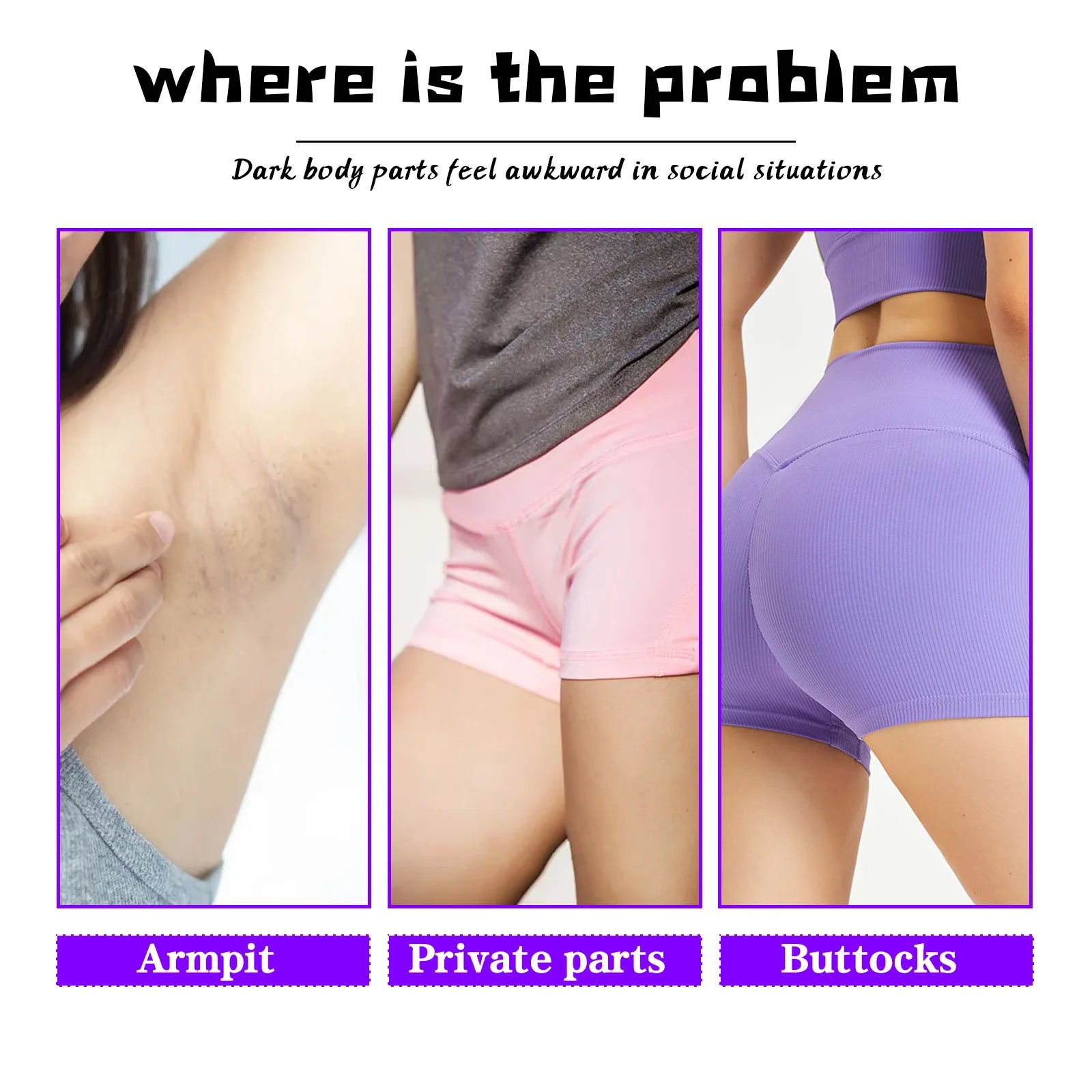 Private Parts Whitening Cream Inner Thigh Darkness Removal Whiten Butt Elbow Dark Spot Melanin Removal Body Snow Bleach Cream Oasis Select