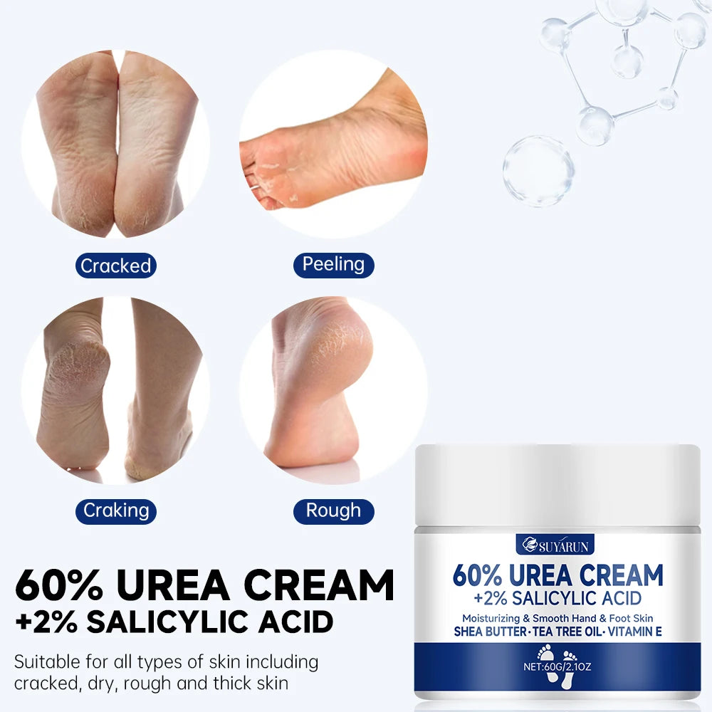 SUYARUN 60% Urea Foot Cream – Callus Remover & Heel Moisturizer Urea Foot Cream Oasis Select