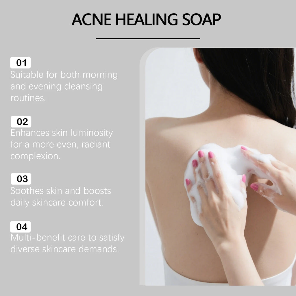 Body Cleansing Soap Gentle Anti Acne Exfoliating Facial & Body Cleanser Brightening Oil Control Soothing Skin Care Shower Soap Oasis Select