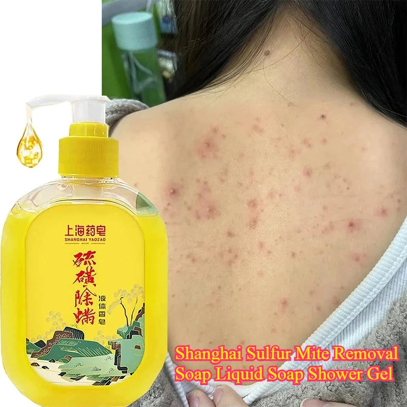 380g Shanghai Sulfur Mite Removal Soap Liquid Soap Shower Gel Deep Cleansing Oil Control Improve Acne Oasis Select Anti-Acne