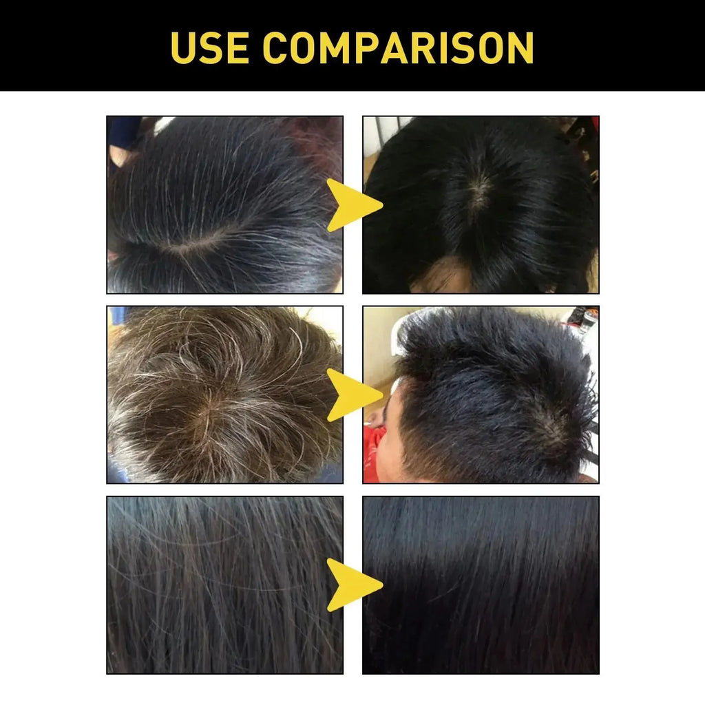 Eelhoe Gray Hair Color Dye Shampoo – Polygonum Multiflorum Hair Color Shampoo Oasis Select