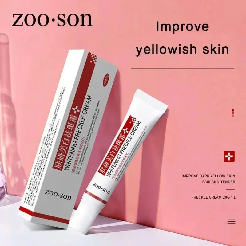 Whitening Freckle Cream Remove Dark Spots Anti Freckle Face Creams Niacinamide Fade Pigmentation Melasma Brighten Skin Care 20g Oasis Select
