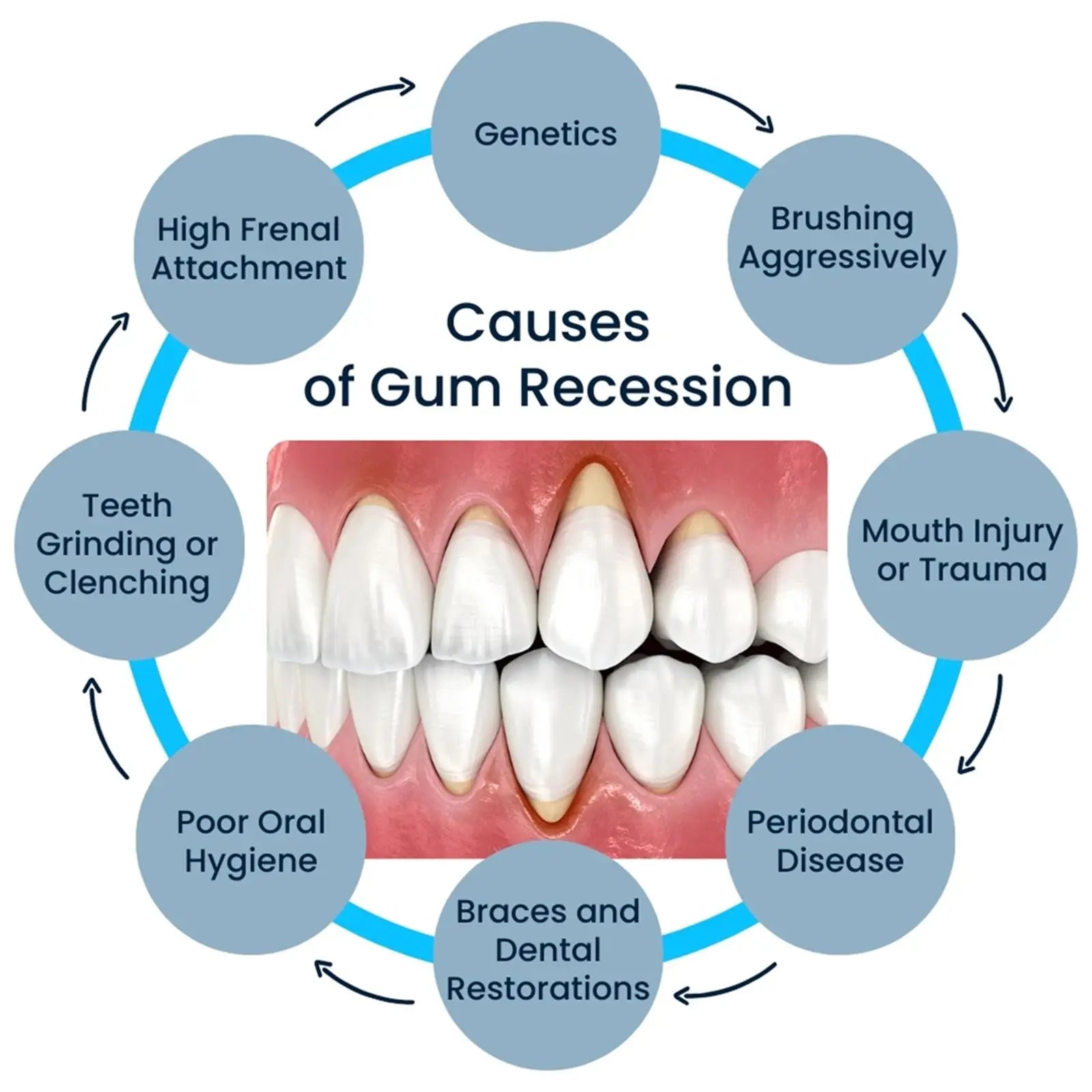 50ML Damaged Gum RepairCare Gel Serum Relieve Sore Gums Allergy Deep Cleaning Teeth Stains Tartar Serum Dental Caries Toothpaste Oasis Select