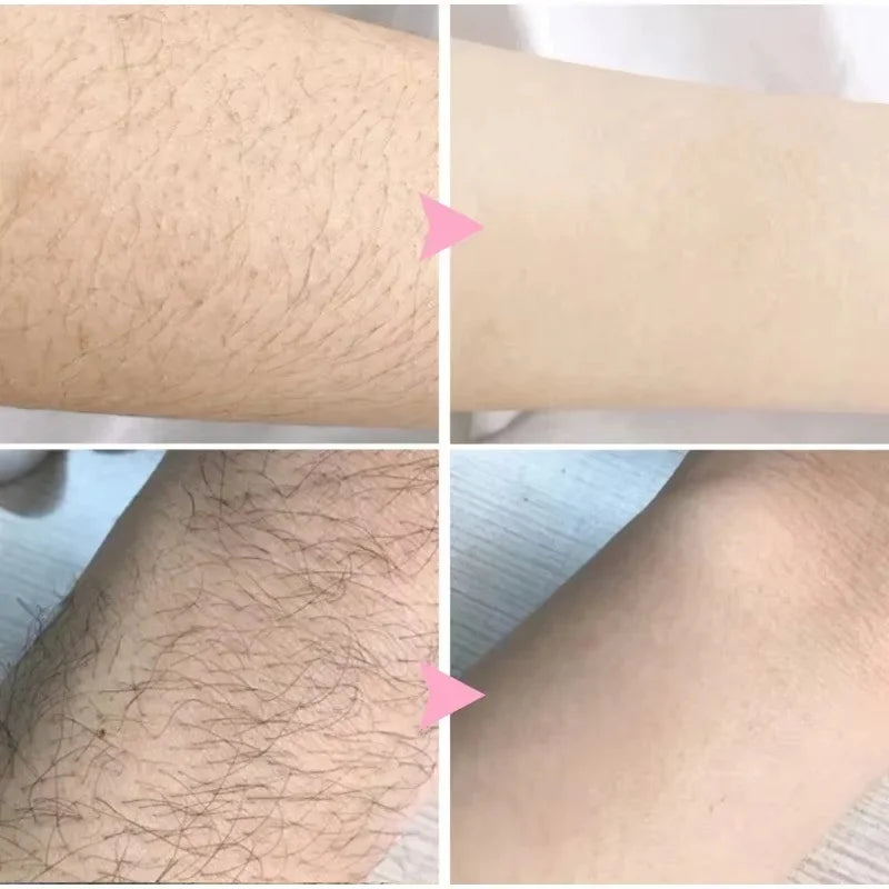 2 Minutes Painless Fast Hair Removal Spray Hair Growth Inhibitor Arm Armpit Leg Permanent Depilatory for Men Women Repair Care Oasis Select