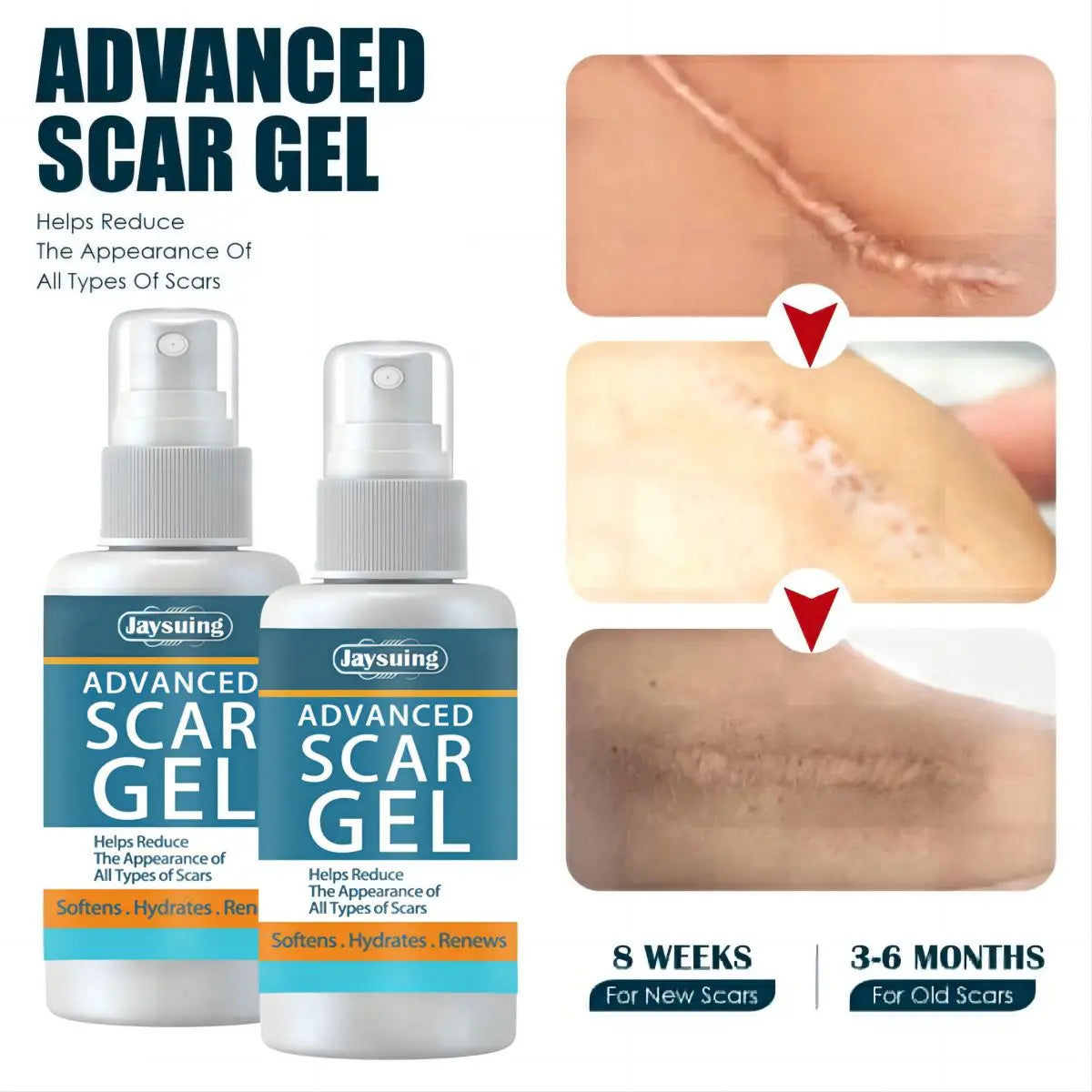 Jaysuing Fade Scar Cream Gel Skin Scar Repair Cream Postpartum Stretch Mark Scar Surgery Smooths Skin Oasis Select