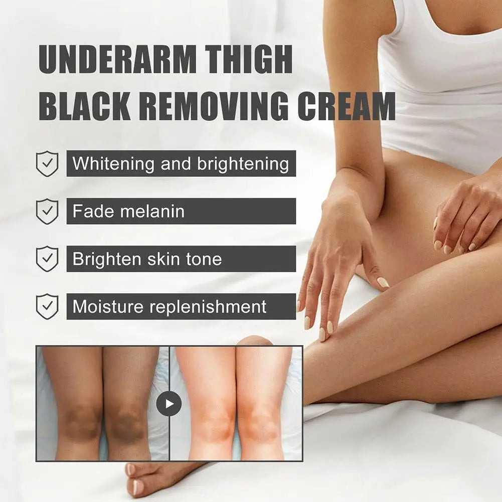 Whitening Underarm Cream For Armpit, Neck, Knees, Elbows, Inner Thigh, Dark Spot Corrector Cream Brightening Natural Skincare Oasis Select