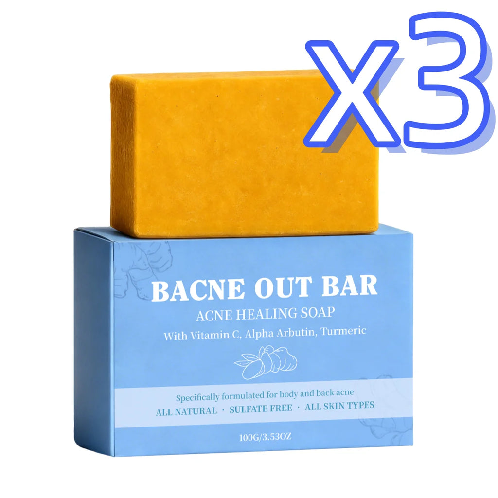 Turmeric Exfoliating Soap Bar – Acne, Dark Spots & Deep Clean Exfoliating Soap Bar Oasis Select 100g Boxed x 3pcs
