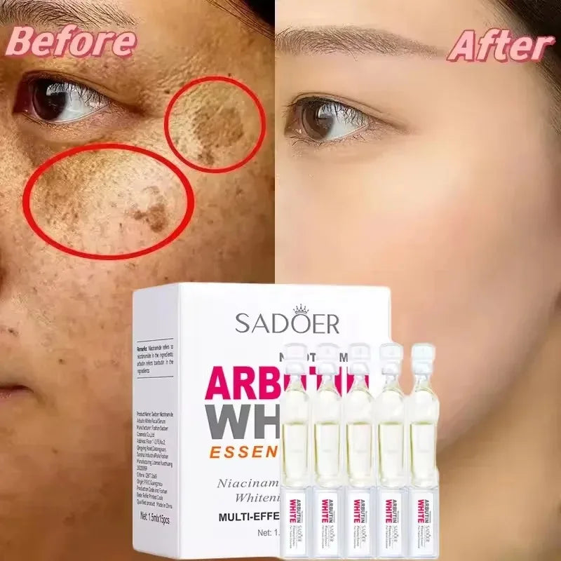 SADOER Niacinamide Facial Essence – Brightening & Moisturizing Niacinamide Face Serum Oasis Select