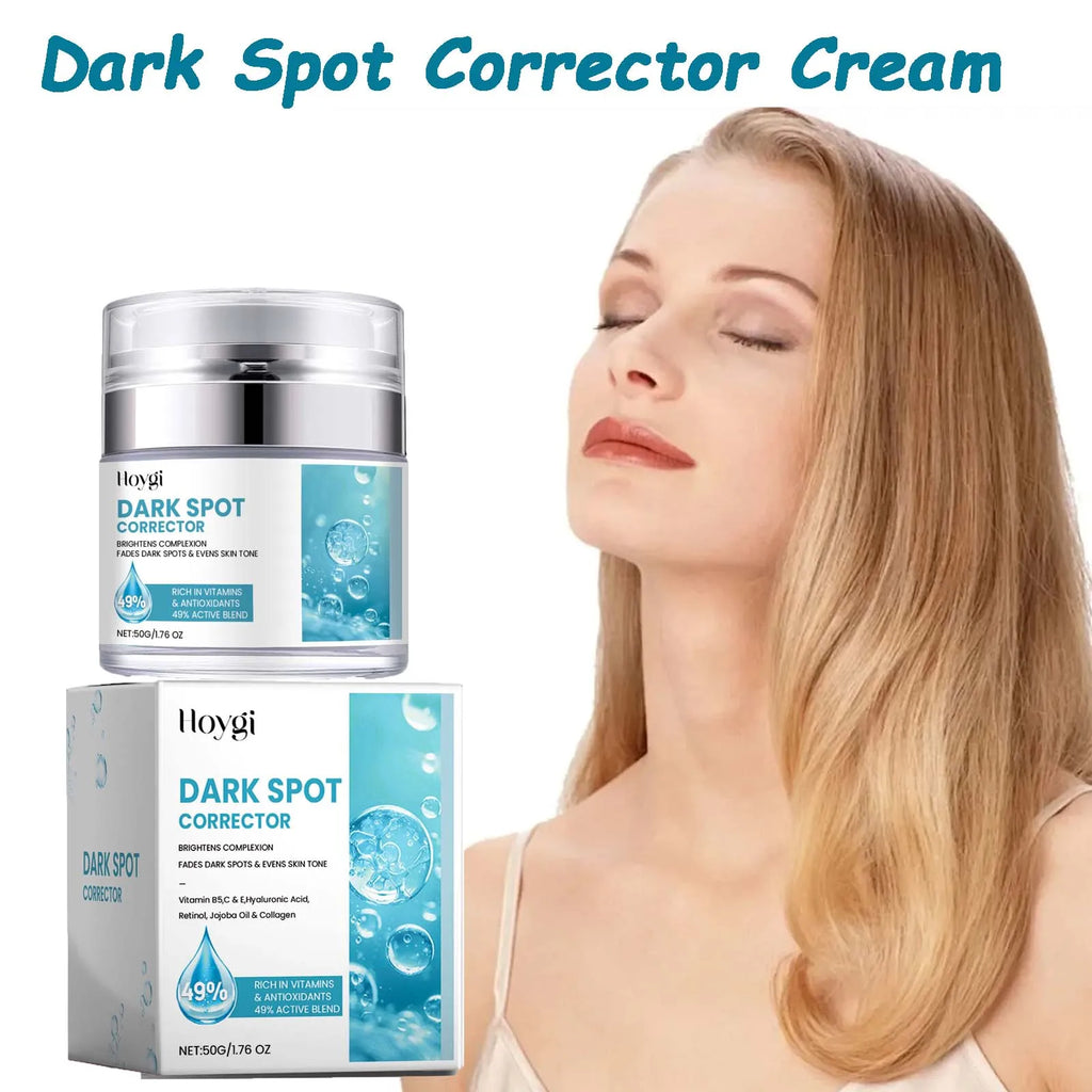 Hoygi Vitamin C Dark Spot Corrector Cream – Brightening 50g Dark Spot Corrector Oasis Select