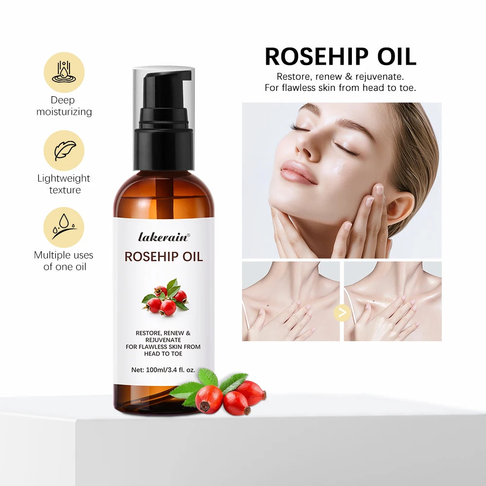 Organic Rosehip Oil 30ml – Face, Body & Hair Moisturizer Face & Body Oil Oasis Select