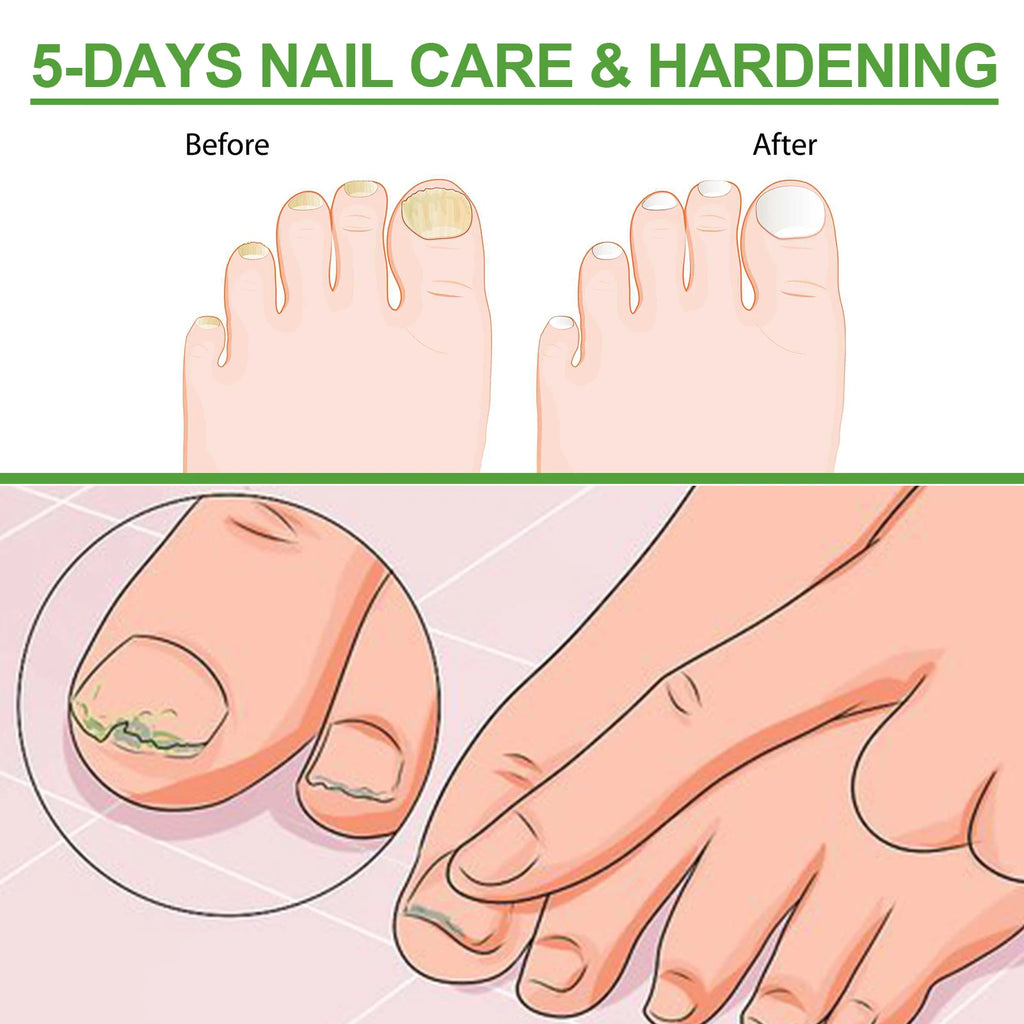 5-Day Nail Care Roller – Nourishing Nail Serum for Hand & Foot Nail Treatment Serum Oasis Select