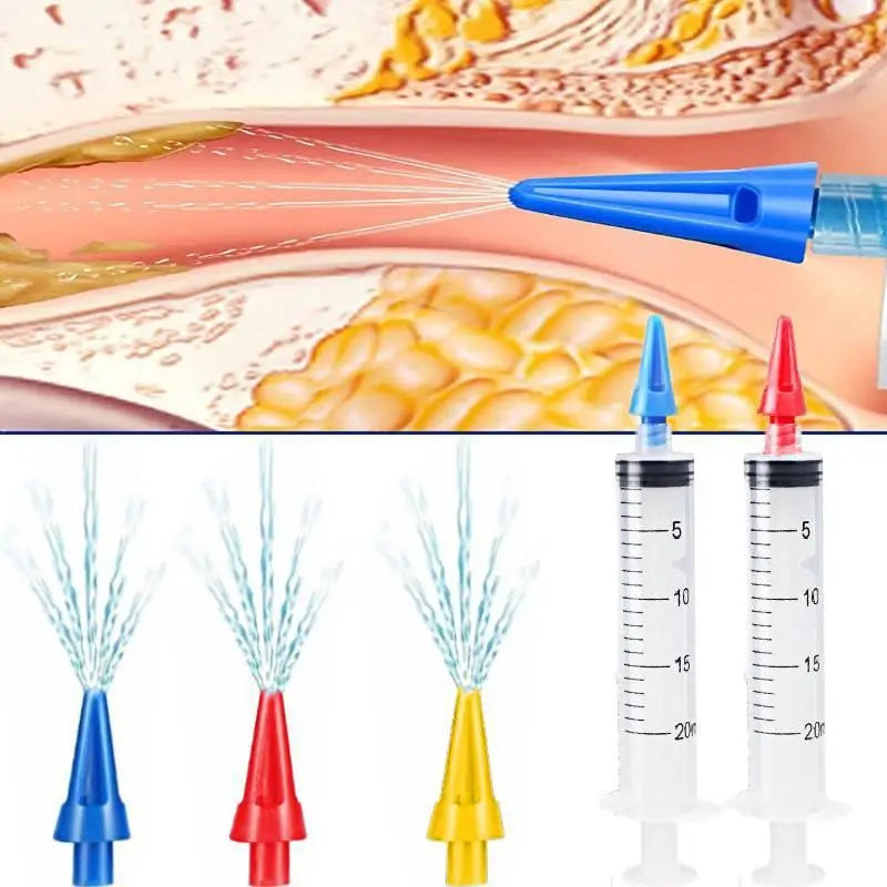 1PCS Ear Cleaner, Ear Irrigation Device, Nasal Cleaning Tool, Earwax Removal Device For Pets, Children, And Adults Oasis Select