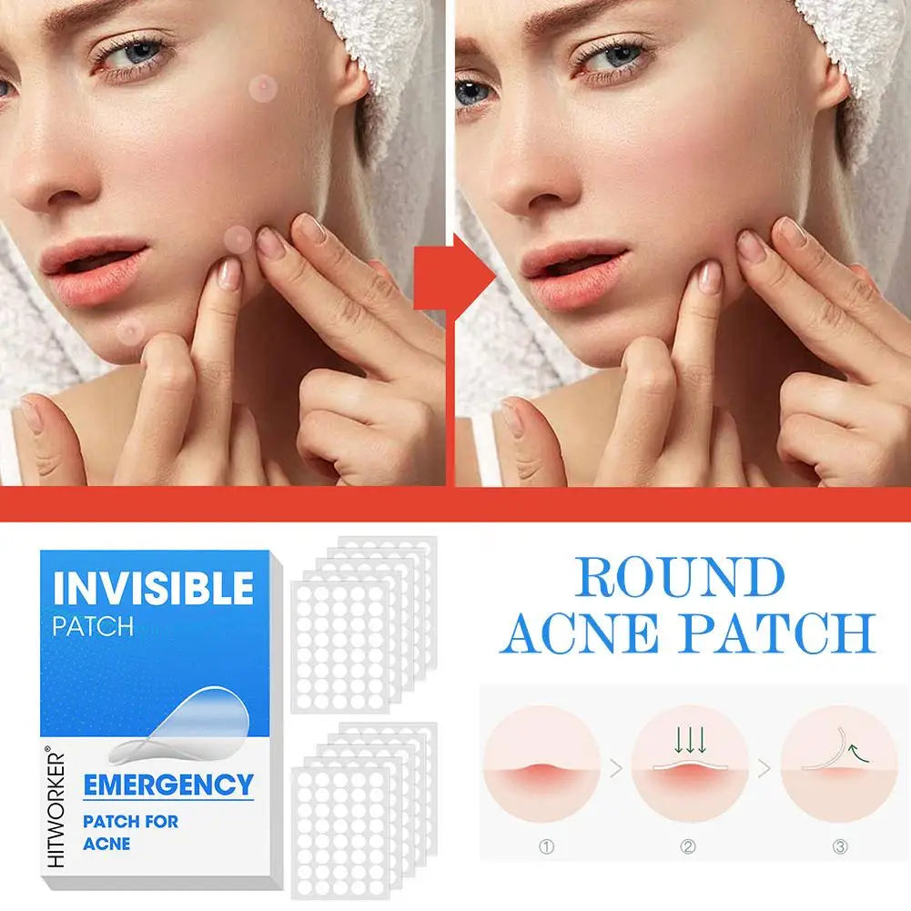 400-1200PCS Invisible Hydrocolloid Pimple Acne Patches Zit Spot Stickers Covering Zits Blemishes W Salicylic Acid & Tea Tree Oil Oasis Select