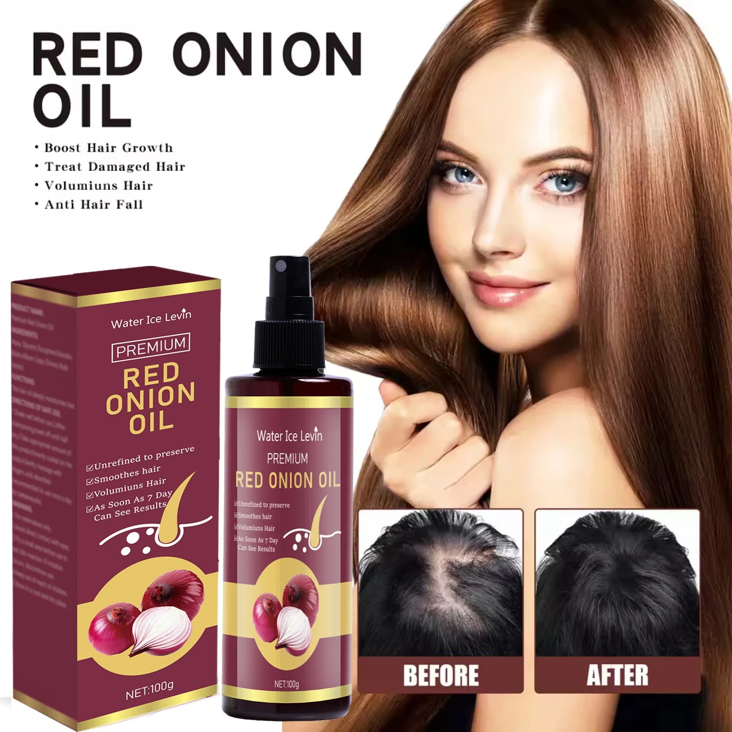 Red Onion Hair Oil with Keratin & Biotin – All Hair Types, 100g Hair Oil Essence Oasis Select