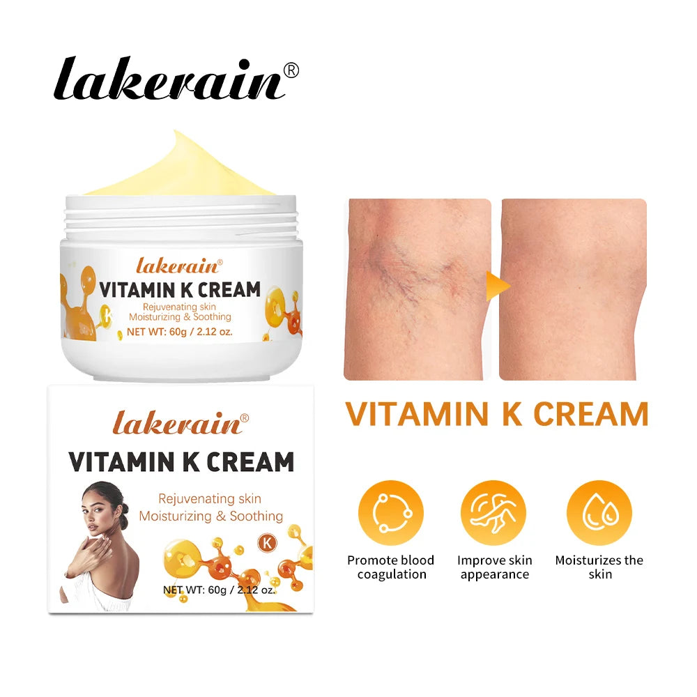 Vitamin K Cream Anti-aging And Wrinkle Removal Varicose Vein Relief Cream Massage Care Relieve Leg Soreness Swelling Ointment Oasis Select VITAMIN K CREAM
