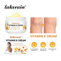 Vitamin K Cream Anti-aging And Wrinkle Removal Varicose Vein Relief Cream Massage Care Relieve Leg Soreness Swelling Ointment Oasis Select VITAMIN K CREAM