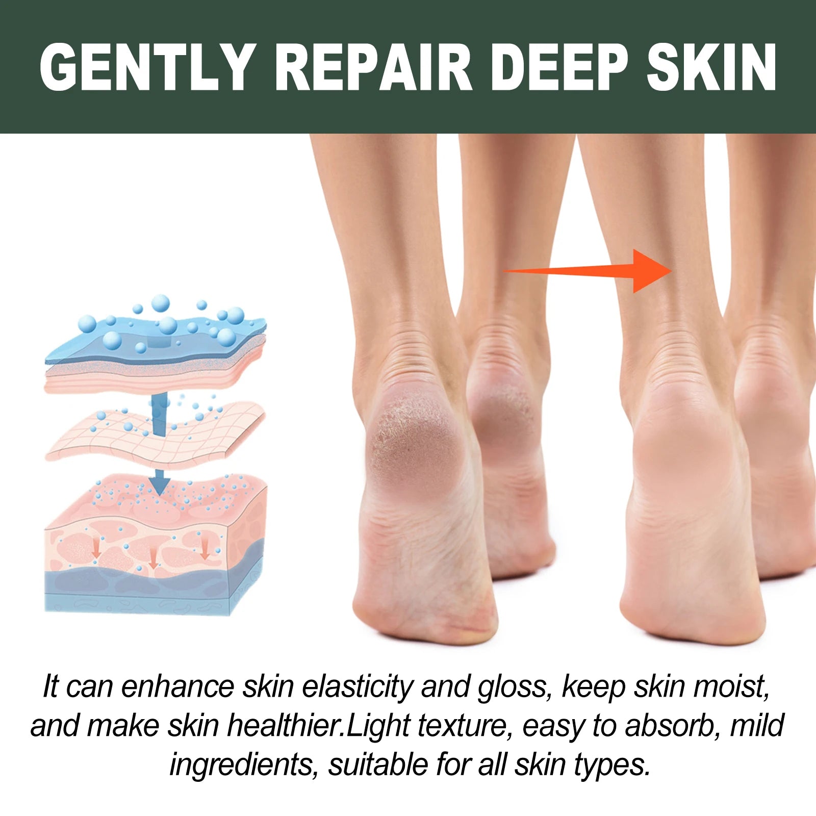 WOODSLEEP Cracked Heel & Hand Repair Cream – Deep Moisturizer Foot & Hand Cream Oasis Select