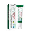 Nicotinamide Dark Spot Corrector Facial Serum Fade Melanin Acne Freckles Removal Brightening Improve Dull Face Care Essence Oasis Select 50ml Boxed