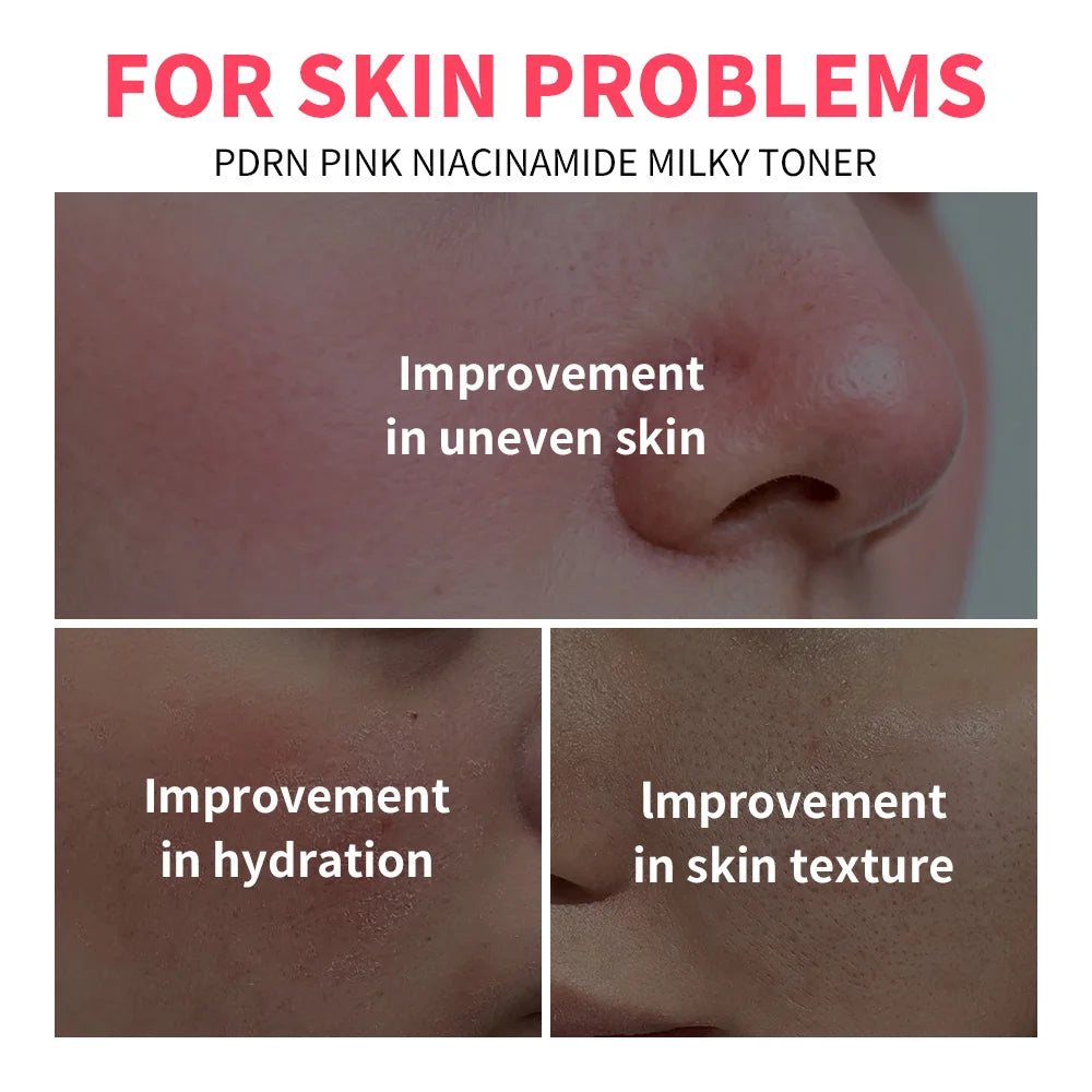 Pink Niacinamide Milky Toner Long-lasting Hydration Even Skin Tone Quickly Absorbed Achieve Dewy Glass Skin Daily Milky Toner Oasis Select