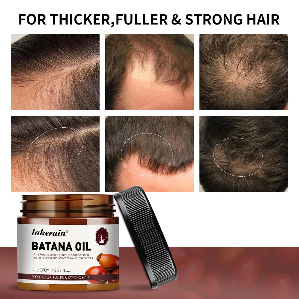 Batana Oil for Hair – Raw Unrefined Oil for Thicker, Fuller Hair