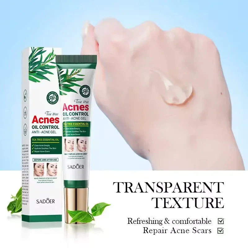 Tea Tree Facial Gel Cream – Oil Control & Blemish Care