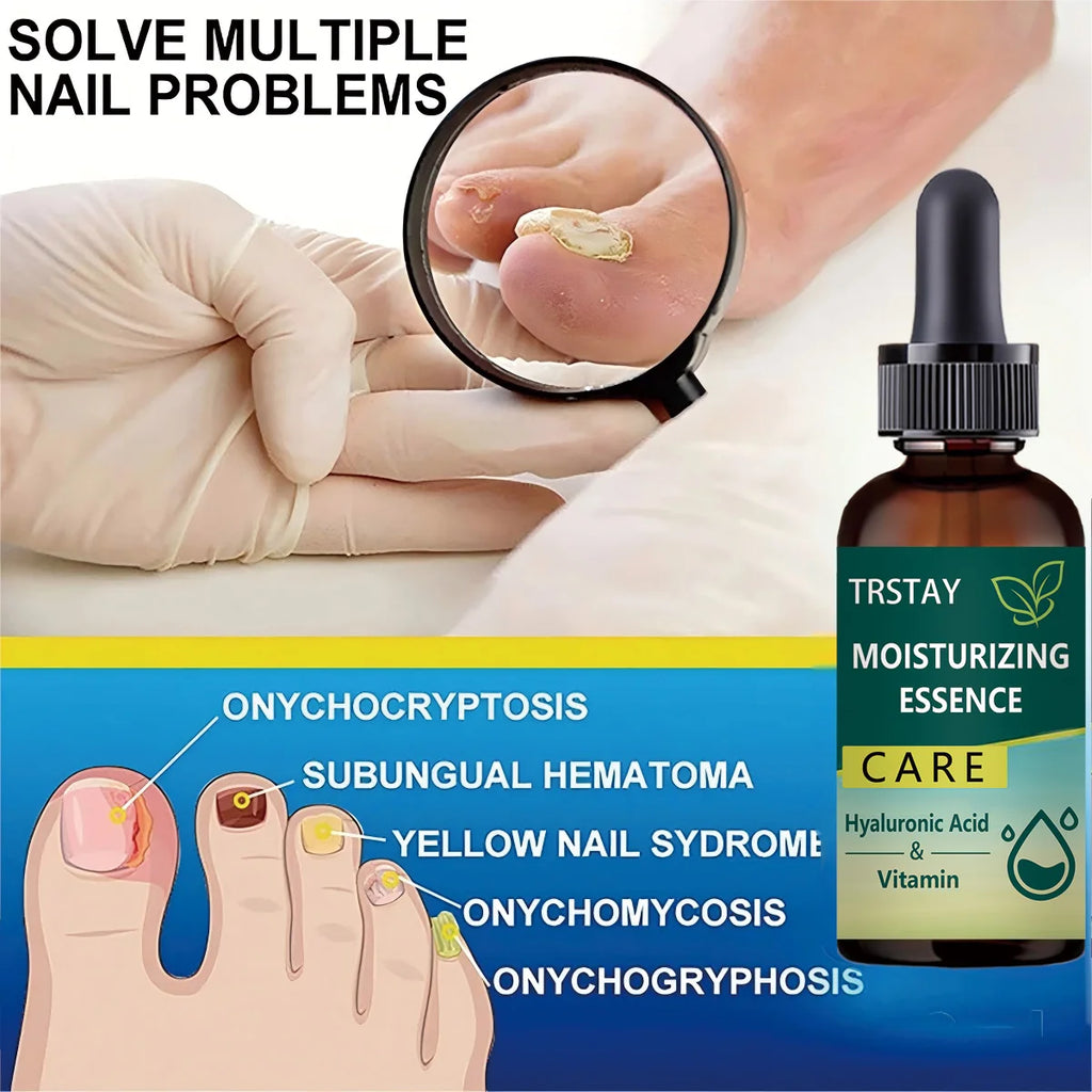 7DAYS Repair Nail Fungus Treatments Essence Foot Care Serum Toe Nails Fungal Removal Gel Anti-Infection Oasis Select