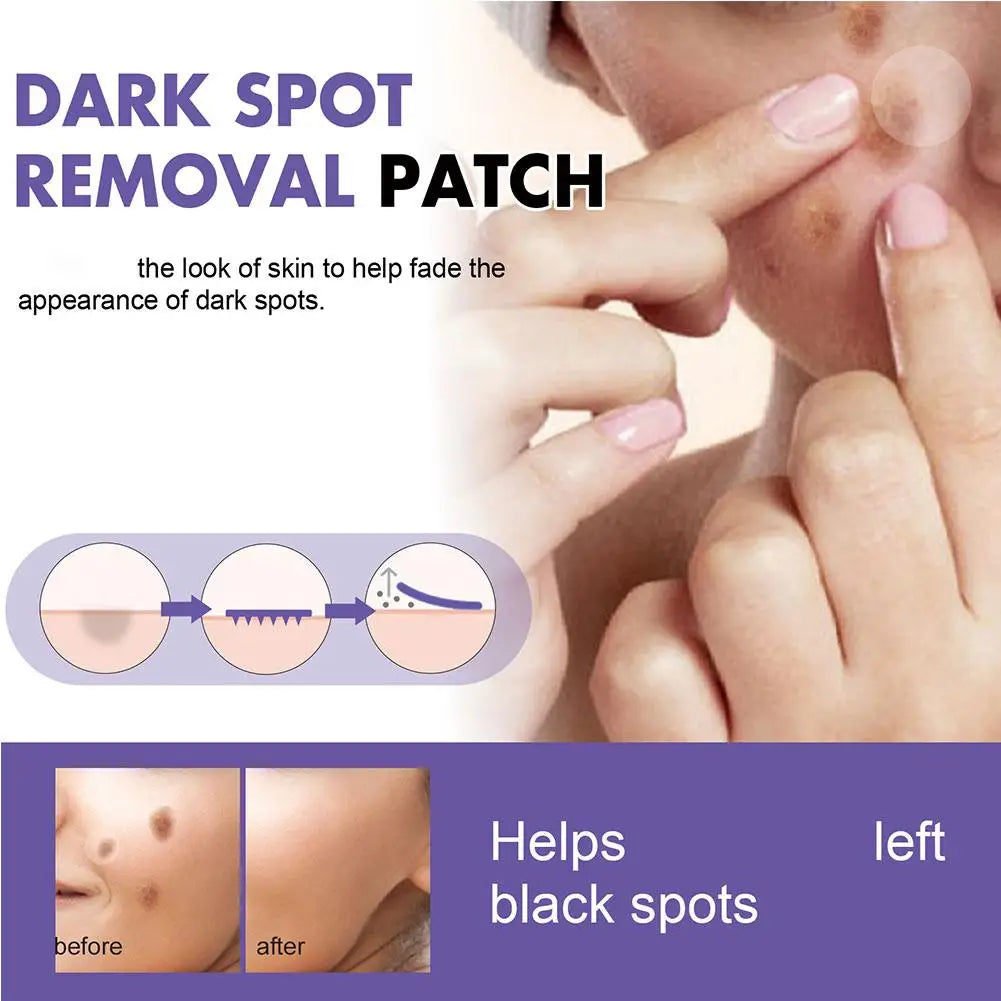 Eelhoe Invisible Acne Spot Patches – 144pc Pimple Cover