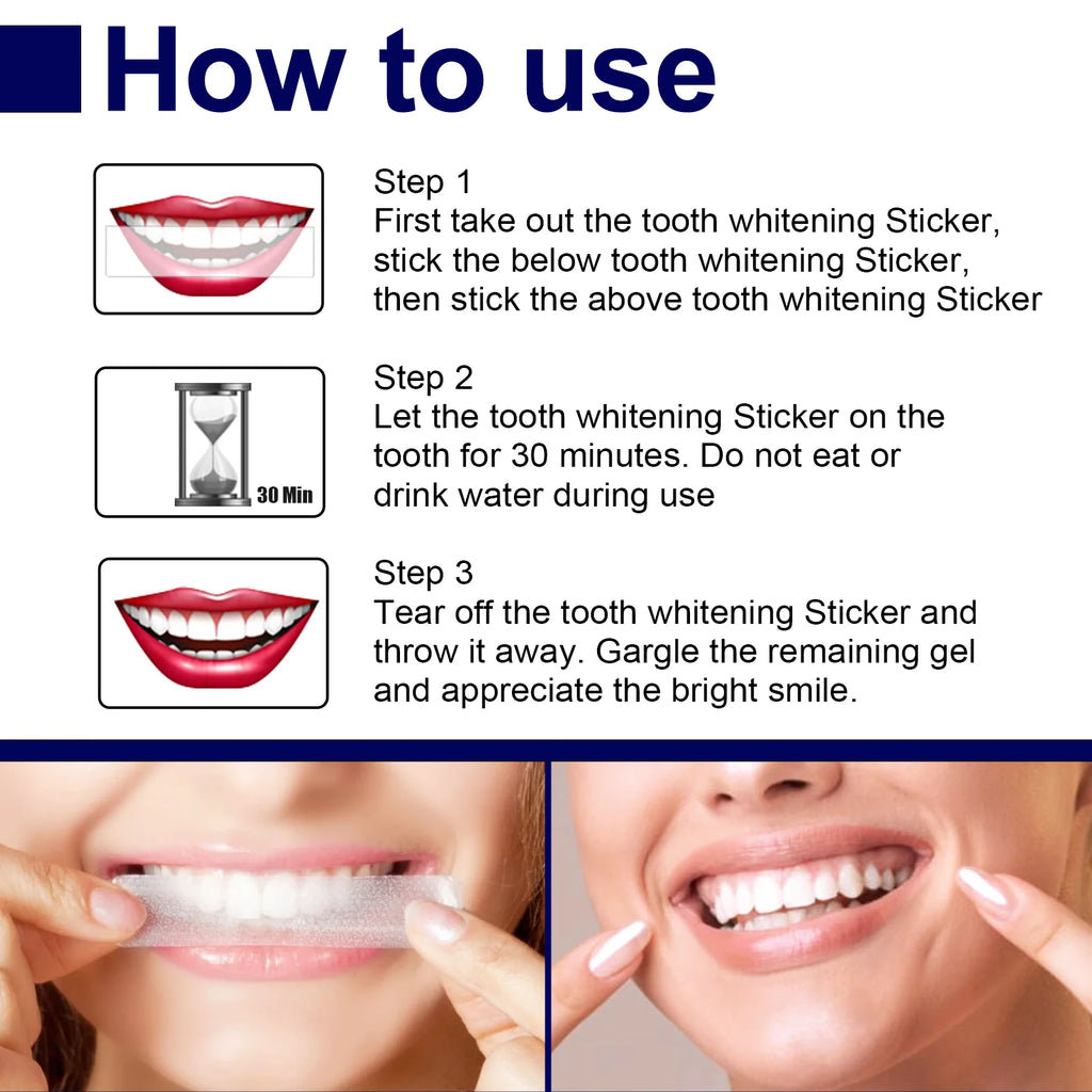Eelhoe Teeth Whitening Strips – Mint Gel, 7 Strips/Box