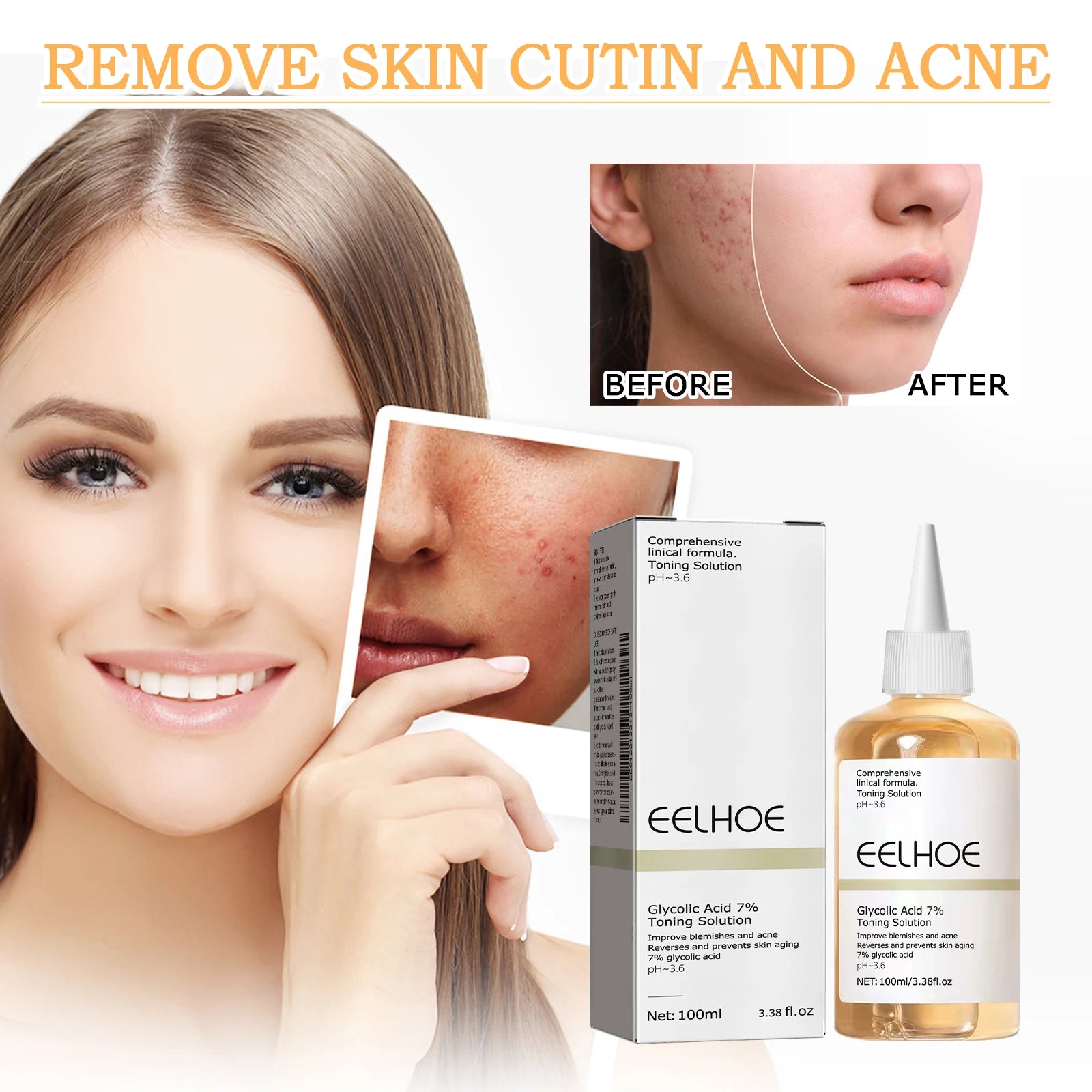7% Glycolic Acid Toner – Brighten, Exfoliate & Hydrate Skin Glycolic Acid Toner Oasis Select