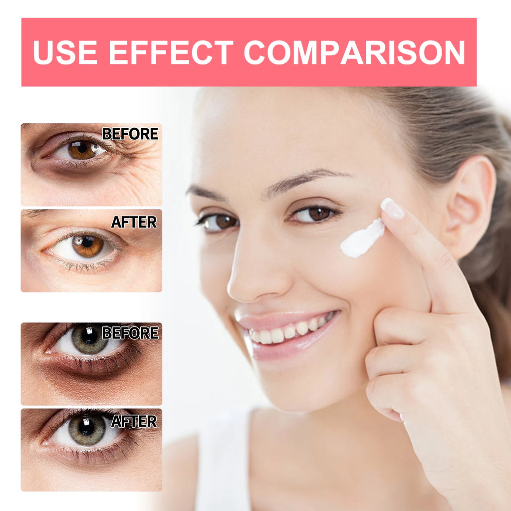 Retinol Eye Cream Wrinkle Remover Lightening Dark Circles Lifting Firming Skin Instant Eye Repair Serum Stick for Women Eye Care Oasis Select