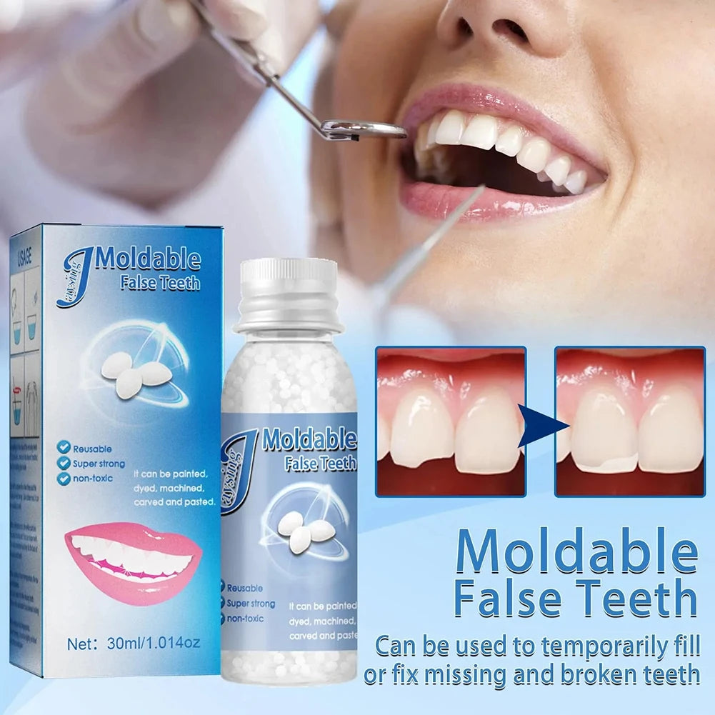 Temporary Tooth Repair Kit – DIY Moldable Filling & Gap Fix