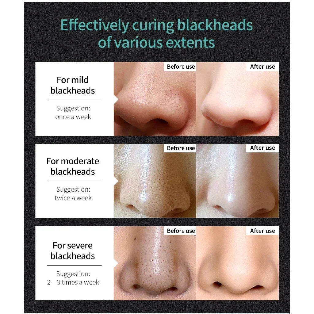 LANBENA Blackhead Remover Nose Black Mask Face Care Mud Peel Off Mask Skin Care 50g Oasis Select
