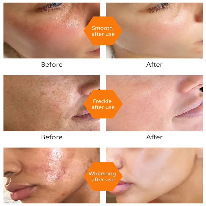 Turmeric Oil Dark Spot Brightening Facial Serum | eelhoe Brightening Face Serum Oasis Select
