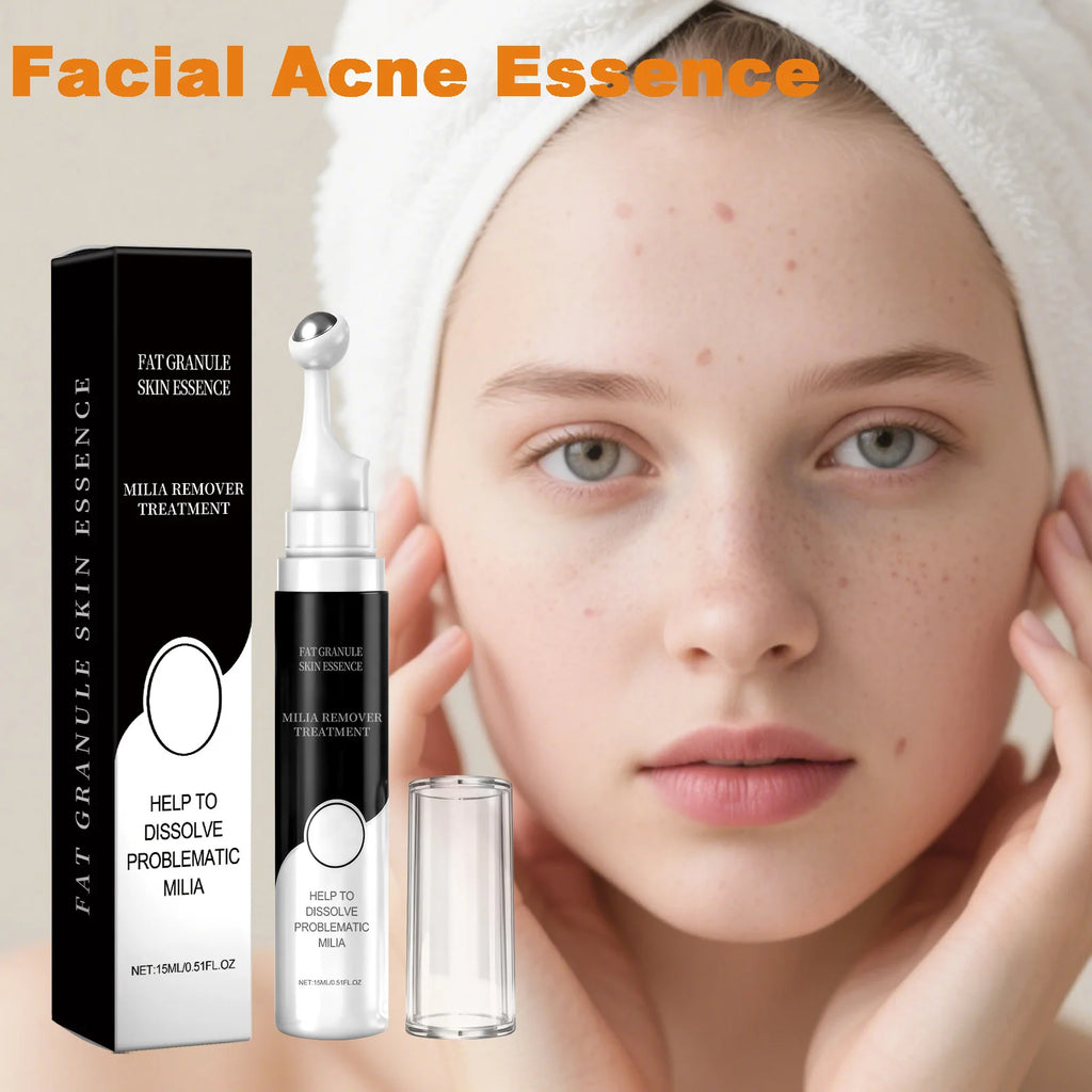 Hoygi Salicylic Acid Acne Serum – Oil Control & Ceramide 15ml Acne Treatment Serum Oasis Select