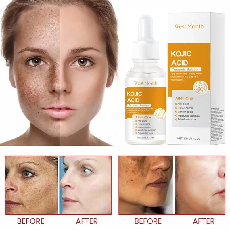 Kojic Acid Brightening Serum – Dark Spot & Tone Corrector