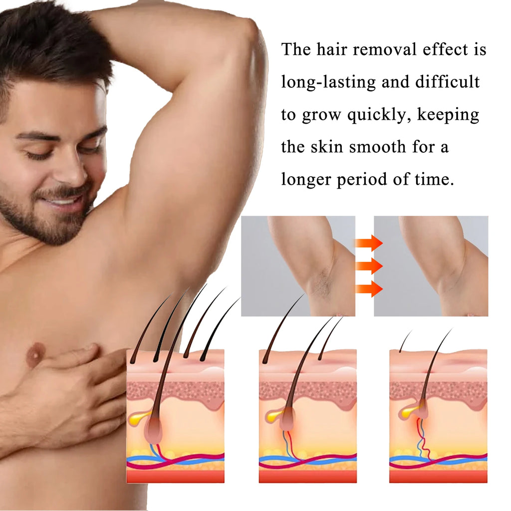 Men's Body Hair Removal Cream Painless Gentle Quick Depilatory Cream For Men Chest Arm Leg Back Smooth Hair Remover Oasis Select