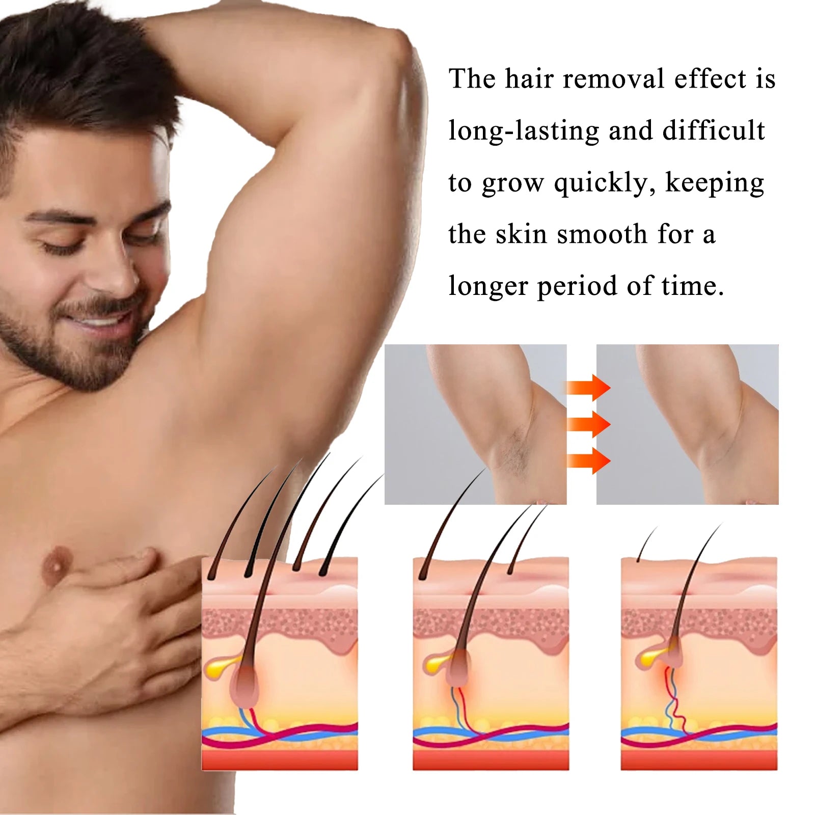 Men's Body Hair Removal Cream Painless Gentle Quick Depilatory Cream For Men Chest Arm Leg Back Smooth Hair Remover Oasis Select