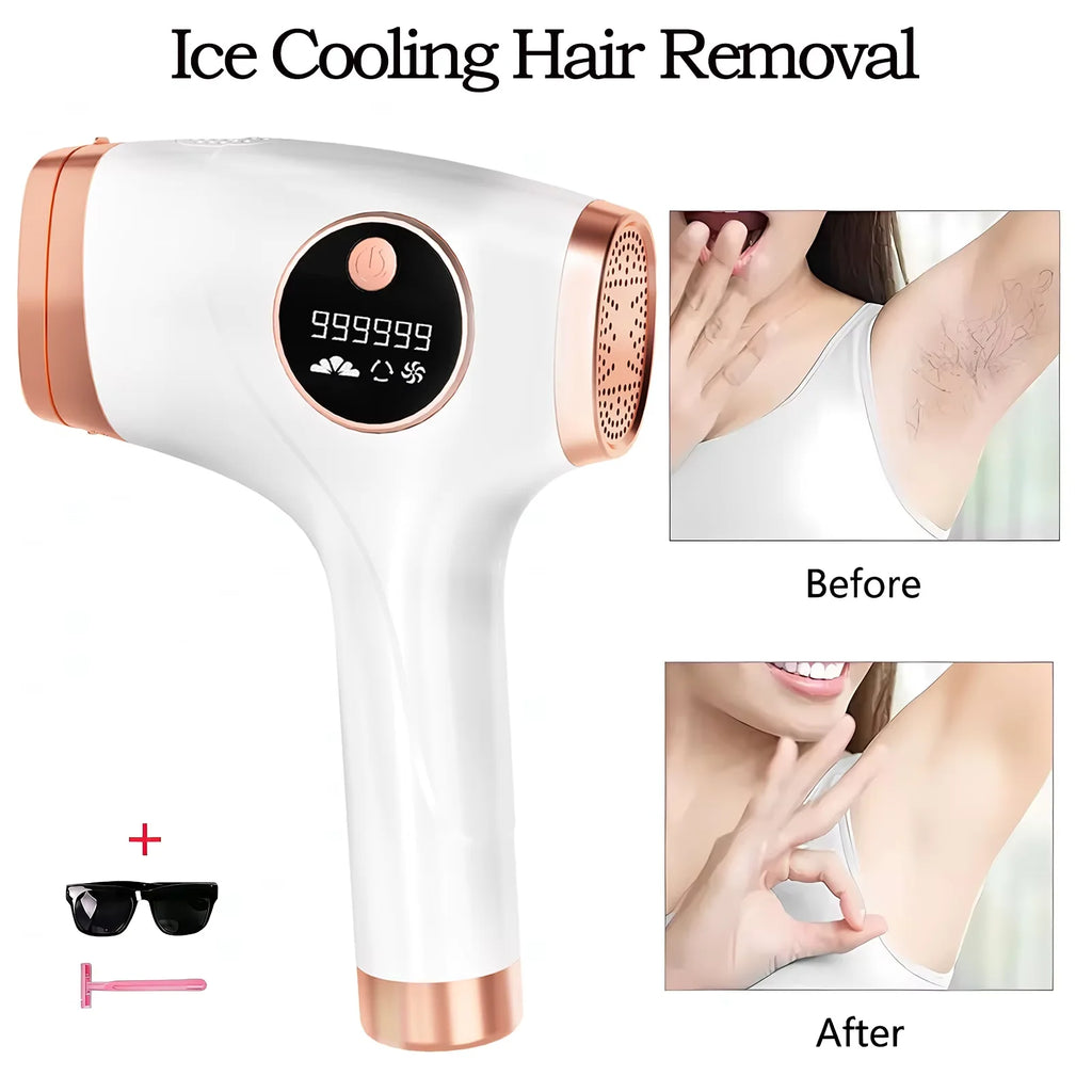 IPL Ice Cooling Hair Removal Device – 999999 Flashes | LCD IPL Hair Removal Device Oasis Select