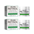 Retinol Whitening Cream for Dark Skin Knee Buttocks Underarm Butt Inner Brightening Private Part Remove Melanin Bleaching Cream Oasis Select 2Pcs