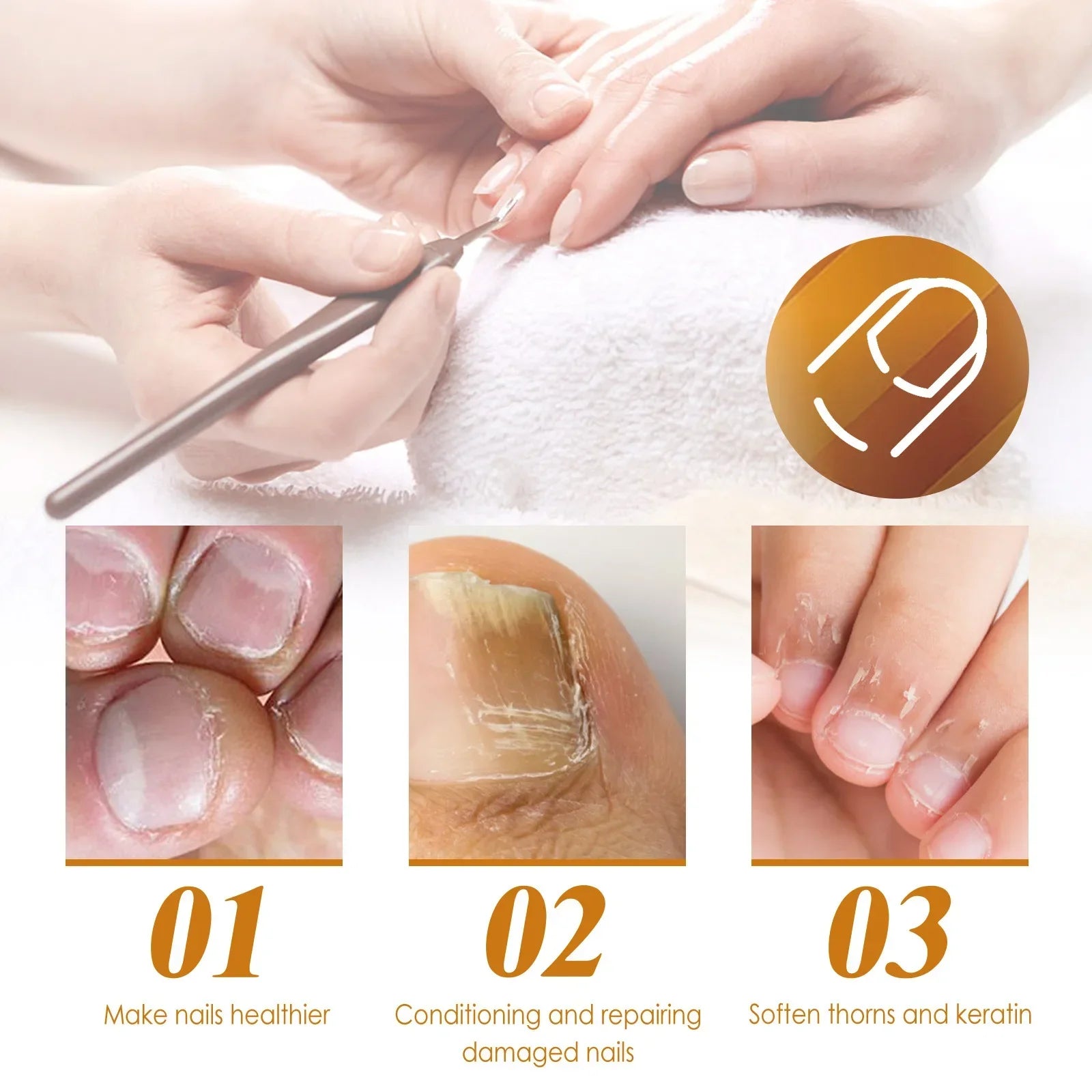 EELHOE Cuticle Removal Gel – Nail Softener & Dead Skin Remover Cuticle Removal Gel Oasis Select