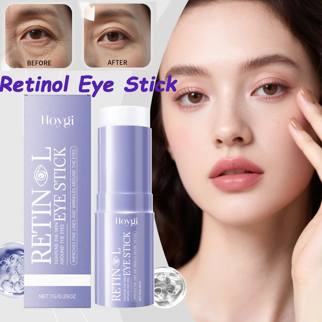 Hoygi Retinol Eye Cream Stick – Dark Circles & Anti-Aging Retinol Eye Cream Oasis Select