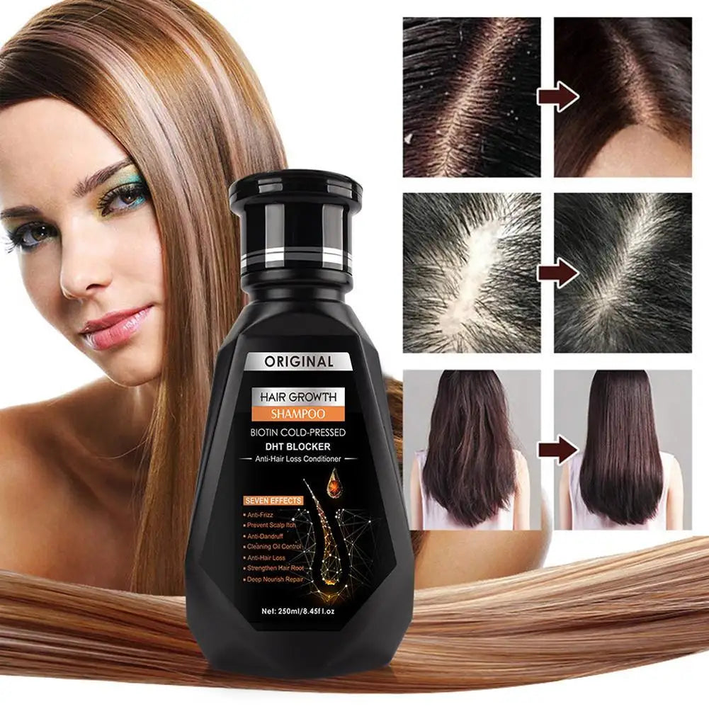 Ginger Hair Growth Shampoo – Scalp Relief & Deep Clean Hair Growth Shampoo Oasis Select