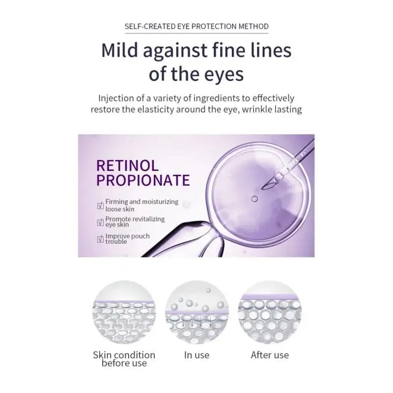 Hyaluronic Acid Eye Cream Roller For Wrinkles Dark Circles Puffiness Anti Aging Treatment Moisturizer Skin Care Oasis Select