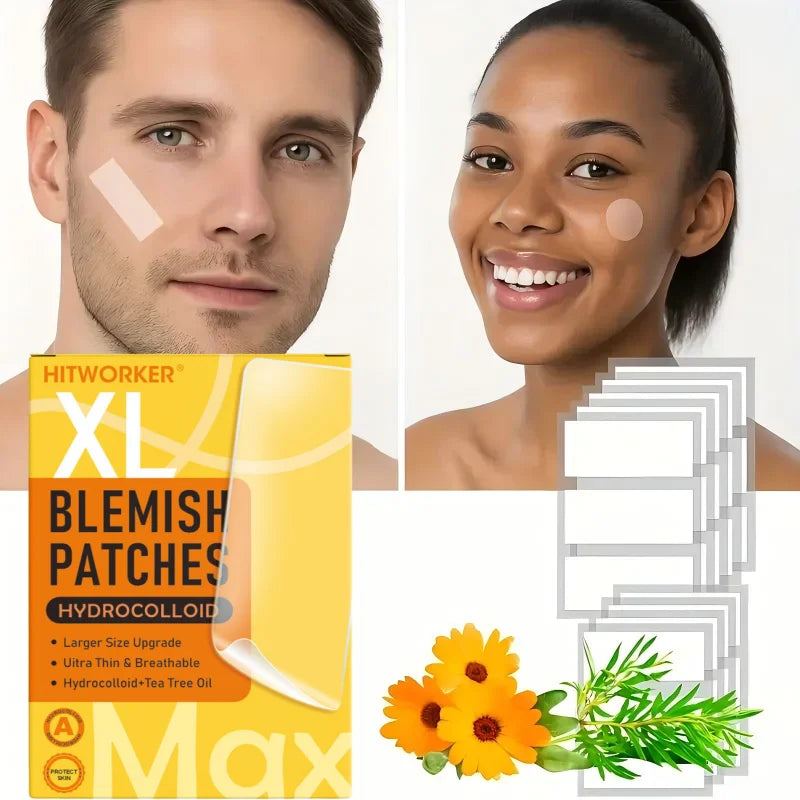 30 pieces/box rectangular type - facial hydrogel concealer sticker, waterproof, non irritating, necessary for Valentine's Day Oasis Select
