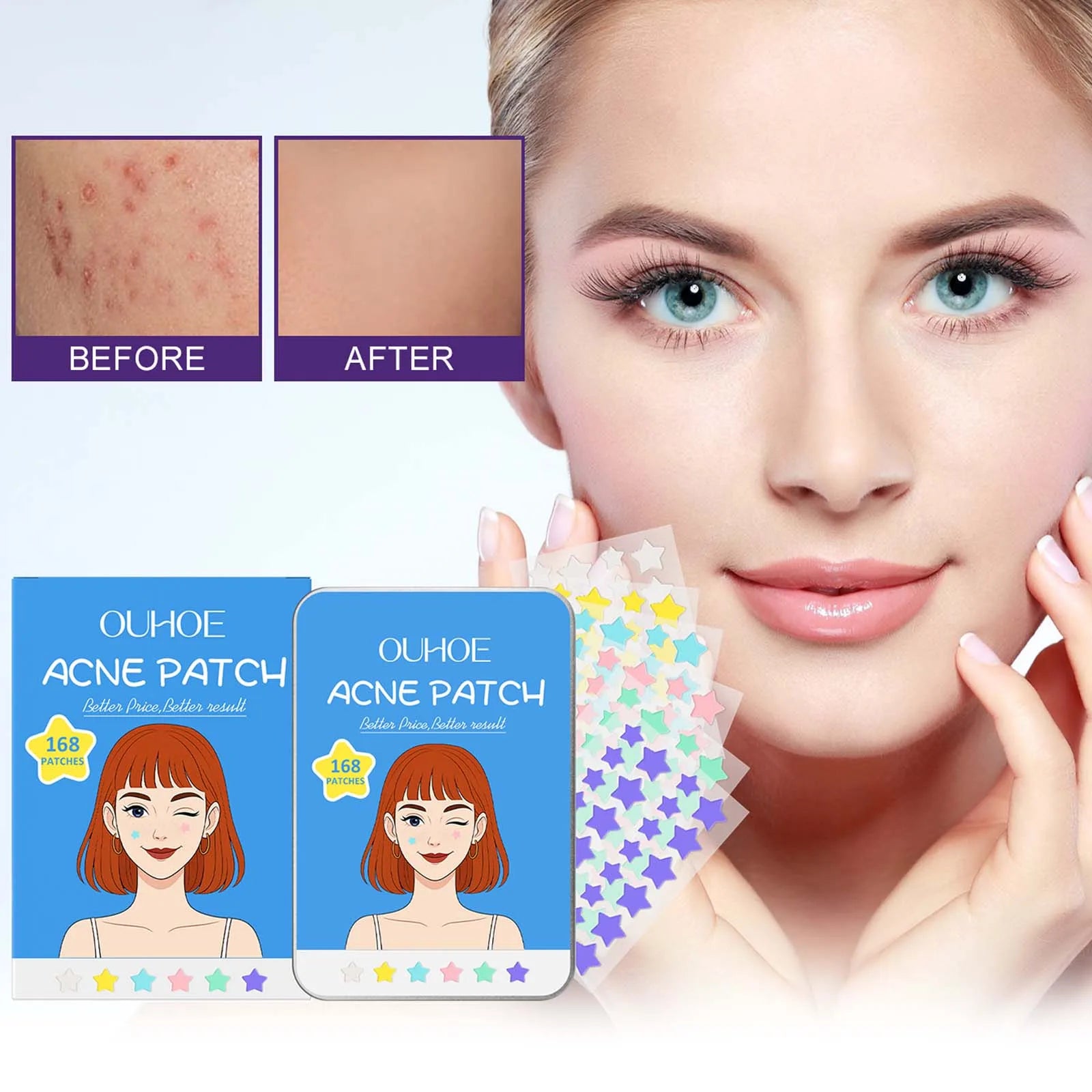 Star Shape Pimple Patches – 168pc Invisible Acne Stickers Acne Pimple Patches Oasis Select