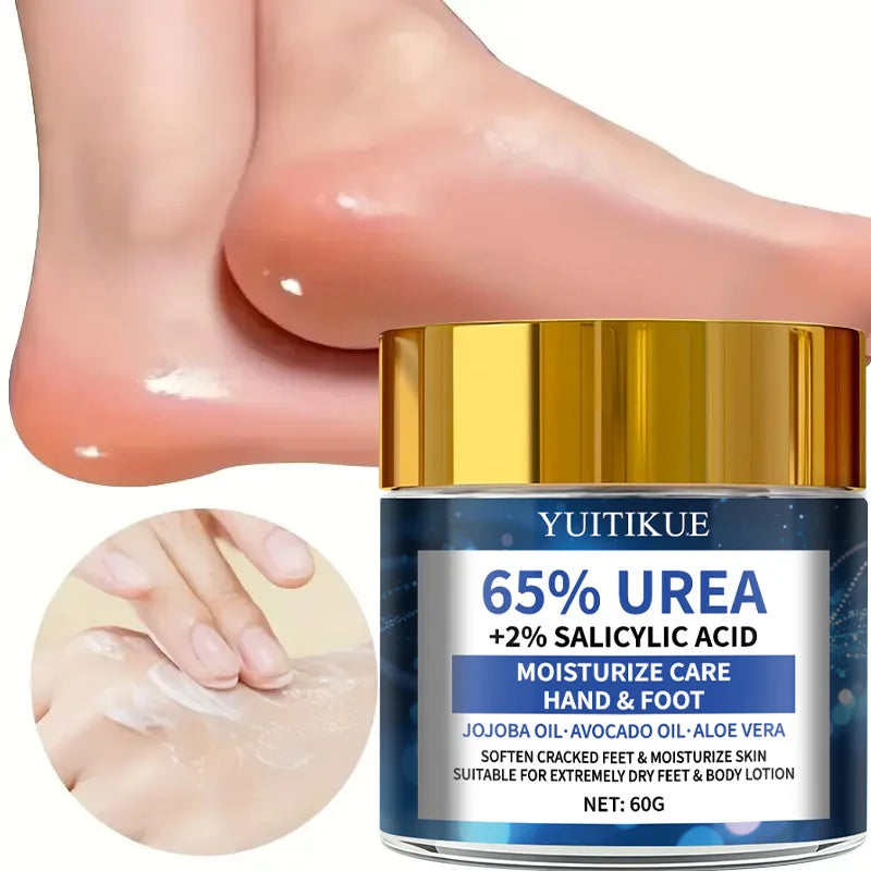 YUITIKUE 65% Urea Foot Cream – Cracked Heel Repair 60g