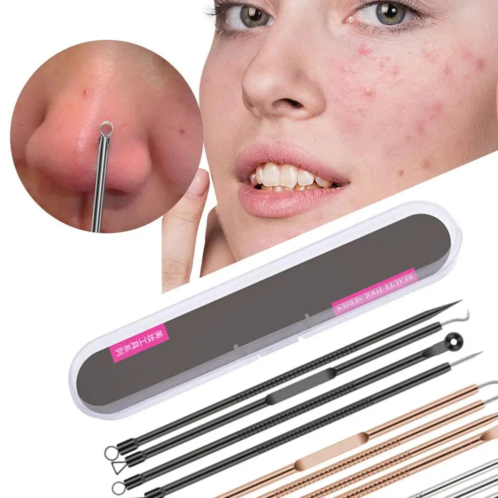 4-Piece Blackhead Remover Tool Set – Stainless Steel Pimple Popper Blackhead Remover Tool Oasis Select